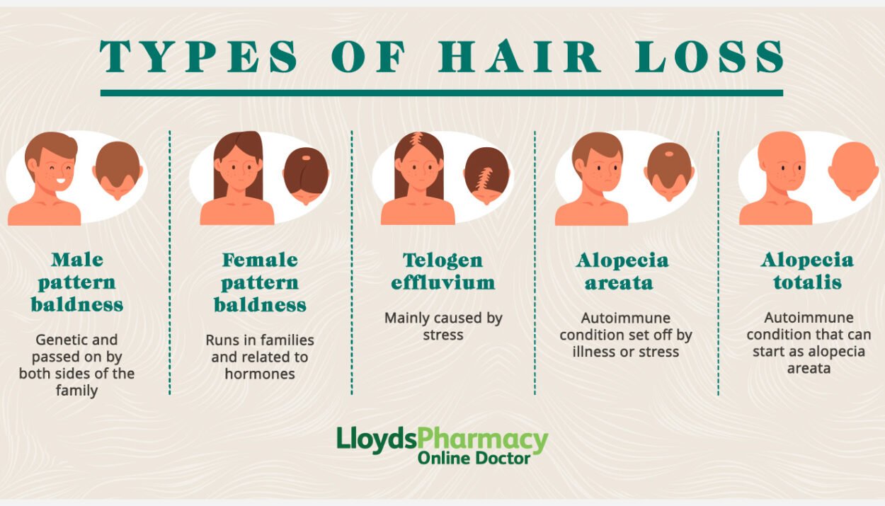 types-of-hair-loss---picture-data